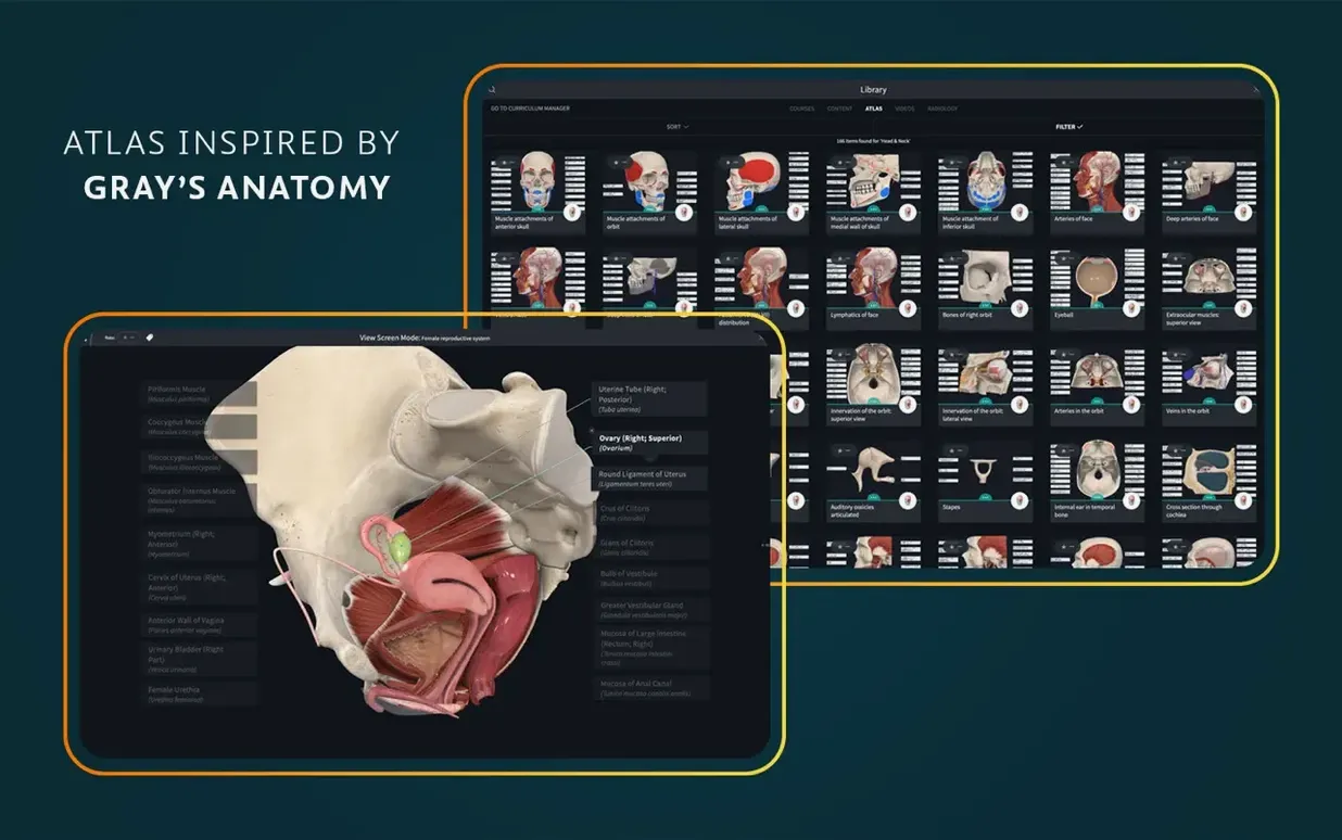 Complete Anatomy: slide 5 of 8 Complete Anatomy example 5