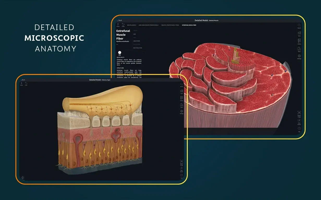Complete Anatomy: slide 6 of 8 Complete Anatomy example 6