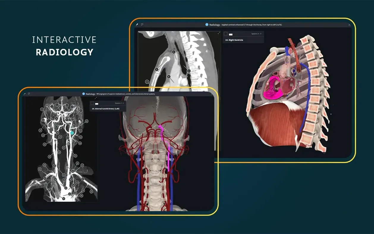Complete Anatomy: slide 7 of 8 Complete Anatomy example 7