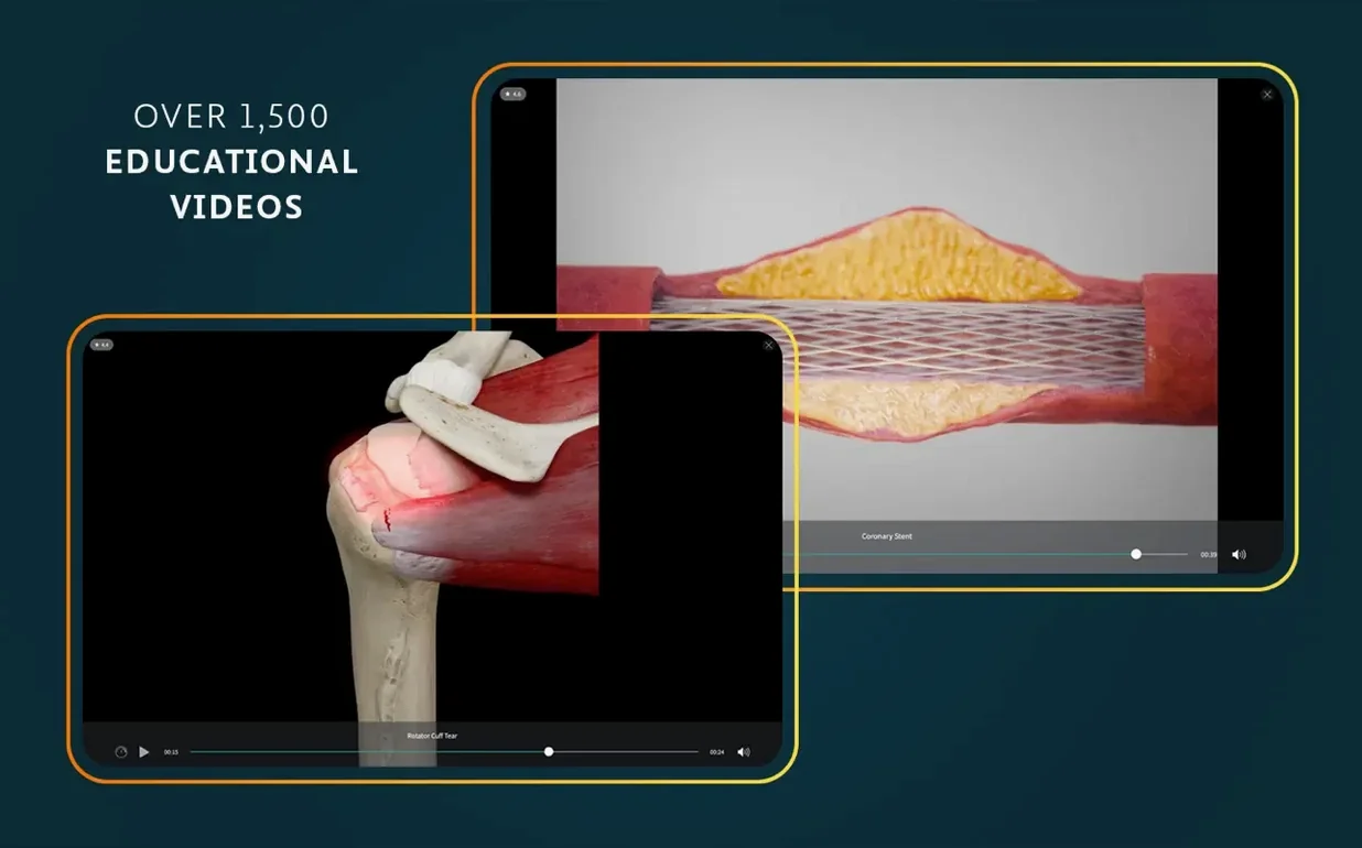 Complete Anatomy: slide 8 of 8 Complete Anatomy example 8
